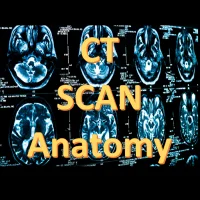 CT Scan Anatomy